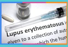 Día Mundial del Lupus: 10 de mayo lupus
